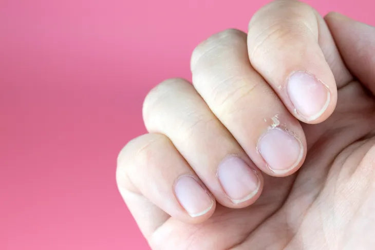Les ongles de Terry, d’où proviennent-ils ? Image