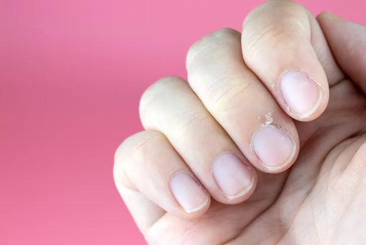 Les ongles de Terry, d’où proviennent-ils ?