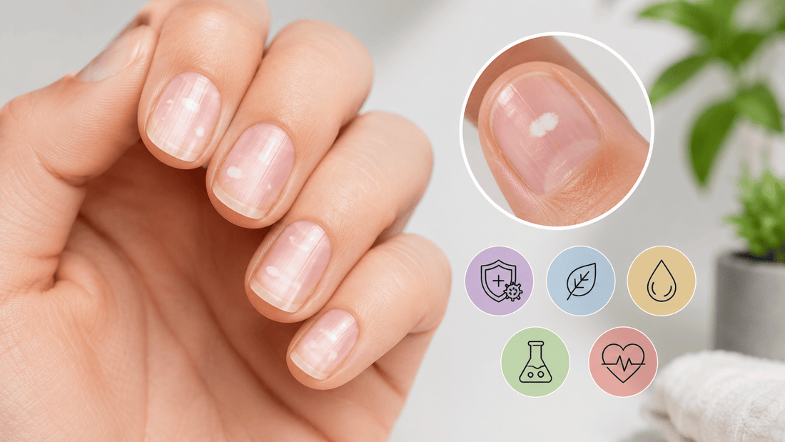 Taches blanches sur les ongles : ce que ça veut vraiment dire (et ce n'est pas le calcium)