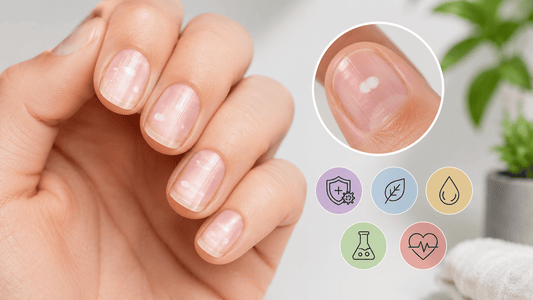 Taches blanches sur les ongles : ce que ça veut vraiment dire (et ce n'est pas le calcium)